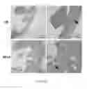 Fig. 48 - METHOD AND KIT FOR MYOCARDIAL REPERFUSION, AND METHOD FOR ATTENUATING OR REDUCING MYOCARDIAL REPERFUSION INJURY