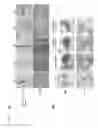 Fig. 02 - Methods for treating PTEN deficient epithelial cancers using a combination of anti-PI3KBETA and anti-immune checkpoint agents