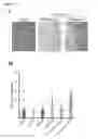 Fig. 08 - Methods for treating PTEN deficient epithelial cancers using a combination of anti-PI3KBETA and anti-immune checkpoint agents