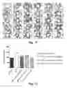 Fig. 07 - Pharmaceutical composition comprising epidithiodioxopiperazine compound or derivative thereof, or pharmaceutically acceptable salt thereof, for preventing or treating pulmonary hypertension