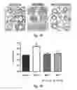 Fig. 09 - Pharmaceutical composition comprising epidithiodioxopiperazine compound or derivative thereof, or pharmaceutically acceptable salt thereof, for preventing or treating pulmonary hypertension
