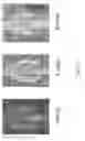 Fig. 08 - Slow release oxysterols and methods of use