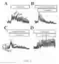 Fig. 03 - COMPOSITION FOR CONTROLLING SECRETION OF PROSTASOMES AND USE THEREOF