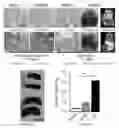 Fig. 02 - Compositions and methods for inhibiting metastasis