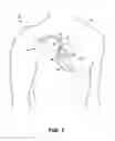 Fig. 08 - Left ventricular assist device adjustment and evaluation