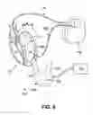 Fig. 09 - Left ventricular assist device adjustment and evaluation