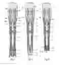 Fig. 02 - Manual injection device
