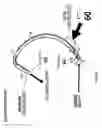 Fig. 06 - Ballooned ventilation tube cleaning device