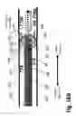 Fig. 40 - Ballooned ventilation tube cleaning device