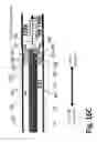 Fig. 41 - Ballooned ventilation tube cleaning device