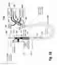 Fig. 45 - Ballooned ventilation tube cleaning device