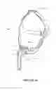 Fig. 07 - Breathing assistance apparatus