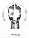 Fig. 08 - Breathing assistance apparatus