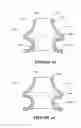 Fig. 33 - Breathing assistance apparatus