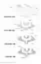 Fig. 82 - Breathing assistance apparatus