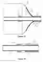 Fig. 13 - Reinforced balloon catheter
