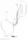 Fig. 02 - Ureteral stent