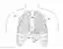 Fig. 01 - Cardiac pacing sensing and control
