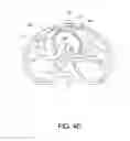 Fig. 07 - Cardiac pacing sensing and control