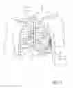 Fig. 02 - Feature based sensing for leadless pacing therapy