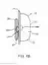 Fig. 09 - METHOD AND APPARATUS FOR TOOTH-MOVEMENT REGULATION