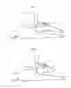 Fig. 02 - Sacroiliac joint exercise assistance device in lateral decubitus position
