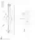 Fig. 04 - APPARATUS AND METHOD FOR REDUCING THE INCIDENCE OF SUDDEN STOPPAGE WITH SELF BALANCING SKATEBOARDS