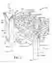 Fig. 02 - Lead board remover
