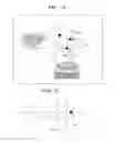 Fig. 10 - Spectacle lens manufacturing method