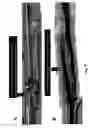 Fig. 06 - Tubular container with invisible longitudinal overlapped side seam
