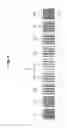 Fig. 08 - INKJET PRINTER