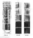 Fig. 25 - Methods and compositions for producing stem cell derived dopaminergic cells for use in treatment of neurodegenerative diseases