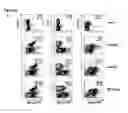 Fig. 07 - Stable pseudotyped lentiviral particles and uses thereof