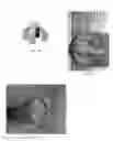 Fig. 10 - Electrochemical layer deposition by controllable anode array