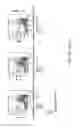 Fig. 06 - FARBER DISEASE MARKERS AND USES THEREOF