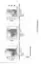 Fig. 08 - FARBER DISEASE MARKERS AND USES THEREOF