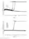 Fig. 04 - Alpha-synuclein detection assay and method for diagnosing alpha-synucleinopathies