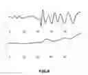 Fig. 07 - Method for improving seismic acquisitions utilising active ultralight seismic detection systems