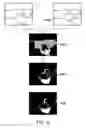 Fig. 06 - Method and computing device for monitoring object