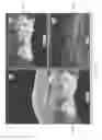 Fig. 08 - Semi-automated system for real-time wound image segmentation and photogrammetry on a mobile platform