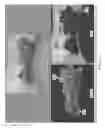 Fig. 10 - Semi-automated system for real-time wound image segmentation and photogrammetry on a mobile platform