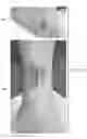 Fig. 12 - Semi-automated system for real-time wound image segmentation and photogrammetry on a mobile platform
