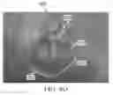 Fig. 16 - Semi-automated system for real-time wound image segmentation and photogrammetry on a mobile platform