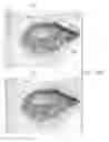 Fig. 18 - Semi-automated system for real-time wound image segmentation and photogrammetry on a mobile platform