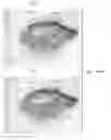 Fig. 19 - Semi-automated system for real-time wound image segmentation and photogrammetry on a mobile platform