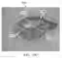 Fig. 20 - Semi-automated system for real-time wound image segmentation and photogrammetry on a mobile platform