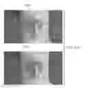 Fig. 22 - Semi-automated system for real-time wound image segmentation and photogrammetry on a mobile platform