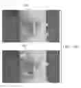 Fig. 23 - Semi-automated system for real-time wound image segmentation and photogrammetry on a mobile platform