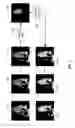 Fig. 04 - Image segmentation based on a shape-guided deformable model driven by a fully convolutional network prior