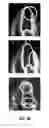 Fig. 06 - Image segmentation based on a shape-guided deformable model driven by a fully convolutional network prior
